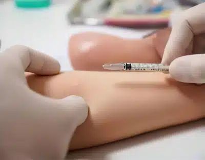 Intradermal Allergy Testing