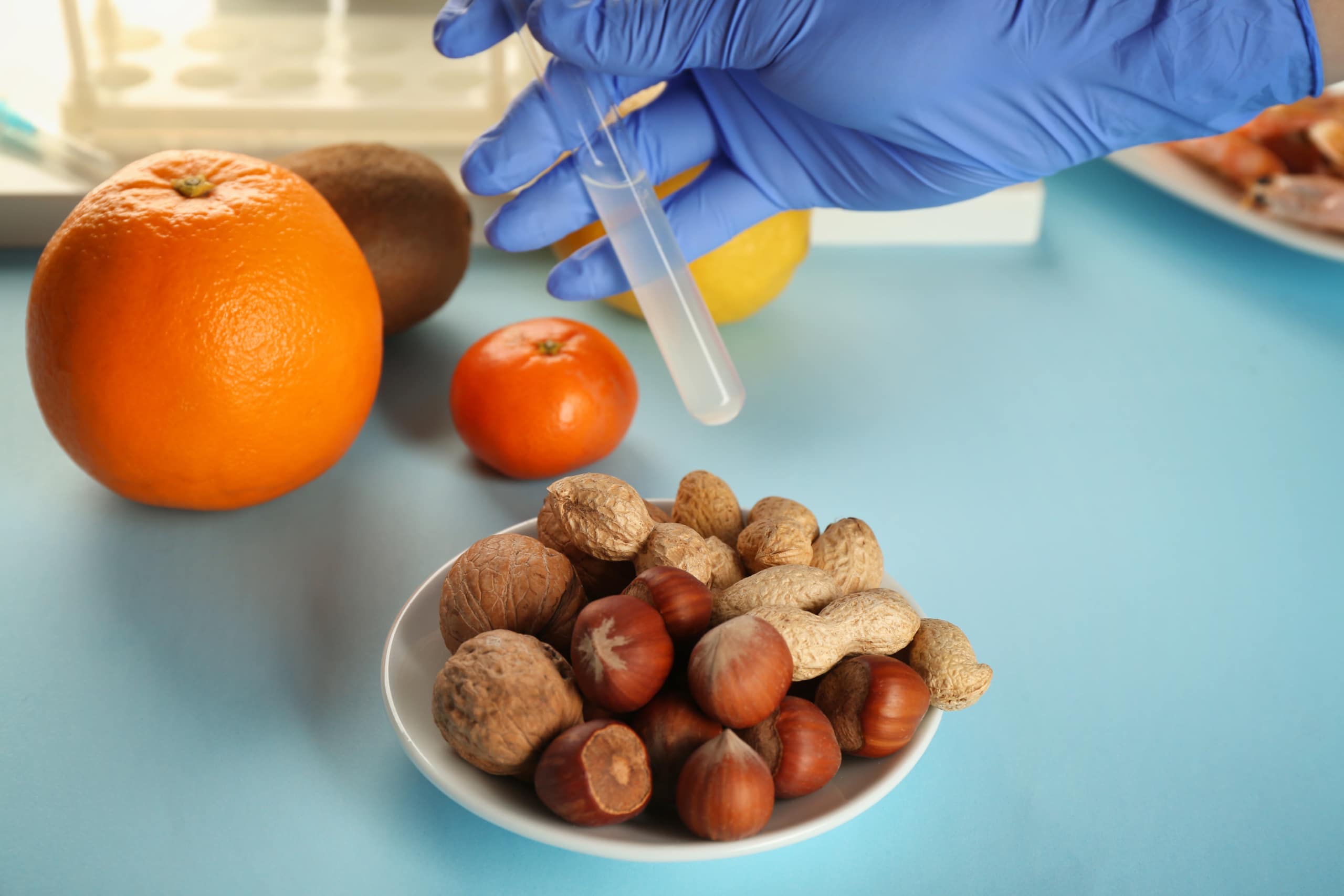 Hand in a blue physician's glove holding a food allergy test tube with a sample over a small bowl of nuts