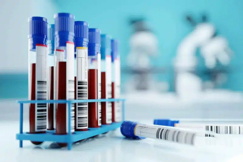 A row of human blood samples in a medical laboratory ready to be tested