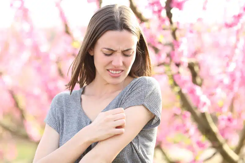 Stressed woman scratching itchy arm after insect bite in a field