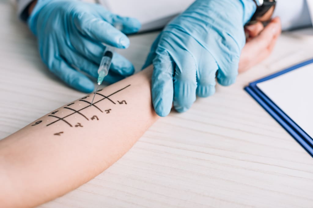 Intradermal allergy testing what it is procedure what to expect