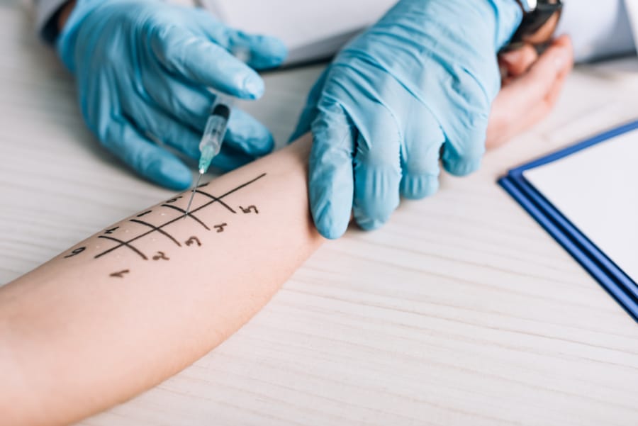 Intradermal Allergy Testing What It Is, Procedure & What to Expect